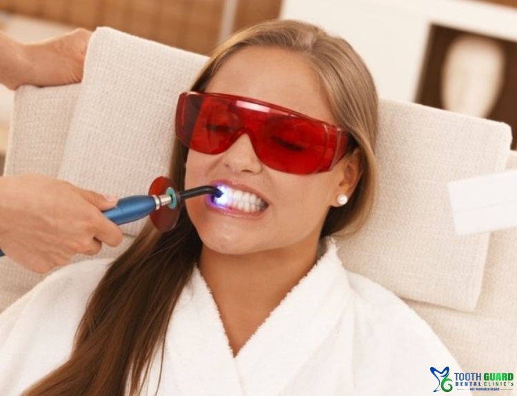 Laser teeth whitening